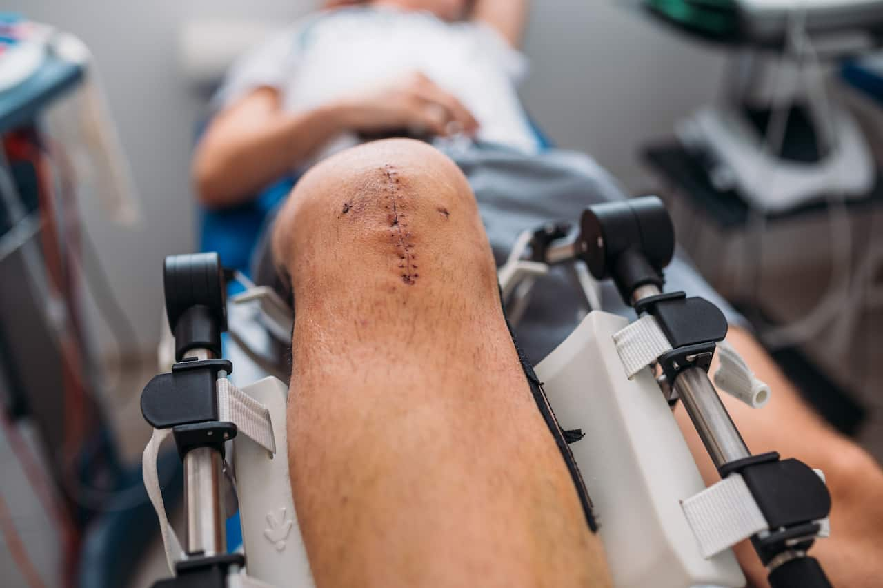 Close-up of a patient's scar after knee surgery.