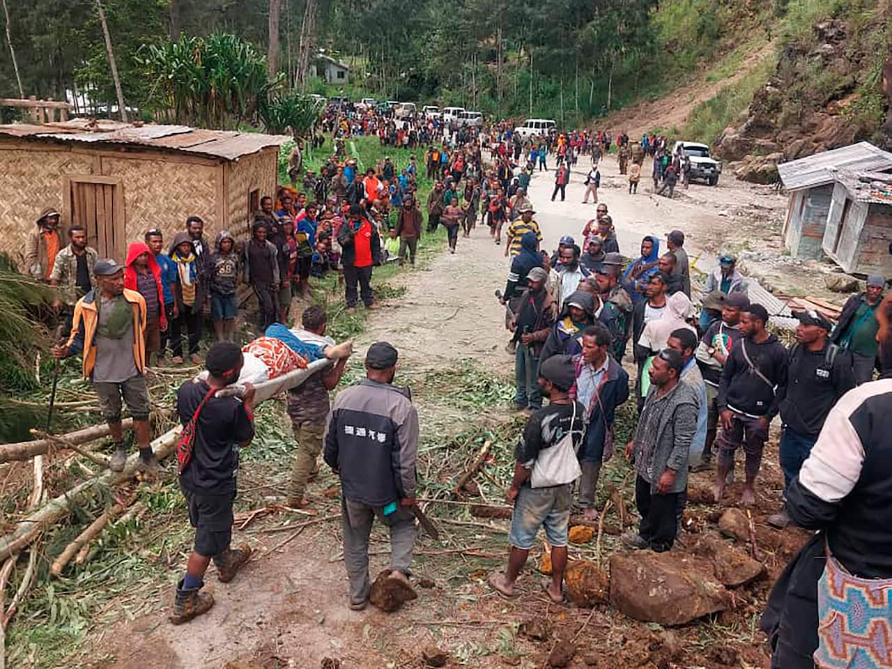 An injured person being carried on a stretcher through a crowd in Yambali village, Papua New Guinea.