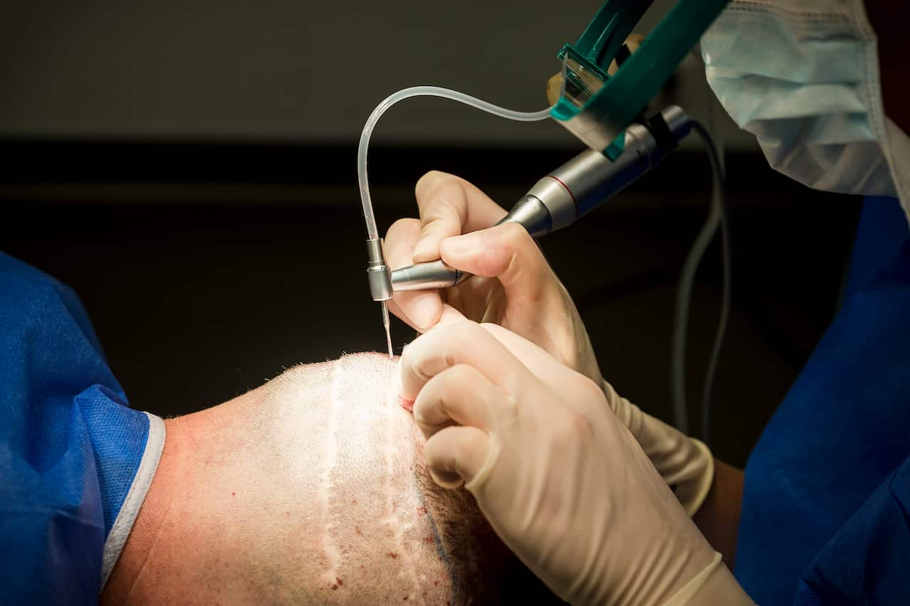 A bald man with two scars is being operated on by a surgeon with a glove and a needle.